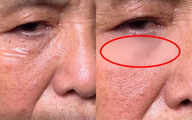 Pha quảng cáo thần dược xóa nhăn giả trân đến nỗi mất luôn cả lông mày-4