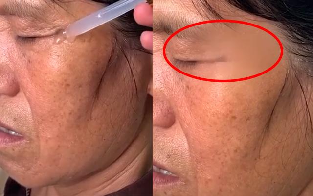 Pha quảng cáo thần dược xóa nhăn giả trân đến nỗi mất luôn cả lông mày-5