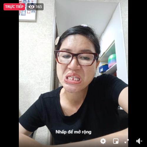 Trang Trần gặp sự cố gãy răng, dân mạng thi nhau haha thay vì thương xót-2