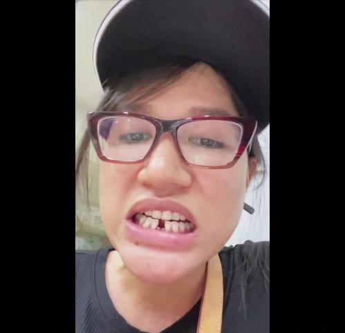 Trang Trần gặp sự cố gãy răng, dân mạng thi nhau haha thay vì thương xót-3