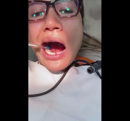 Trang Trần gặp sự cố gãy răng, dân mạng thi nhau haha thay vì thương xót-4