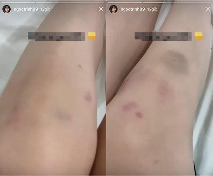 Hari Won, Ngọc Trinh bất chấp bầm dập vì nghệ thuật nhưng người cuối mới đáng ngưỡng mộ-2