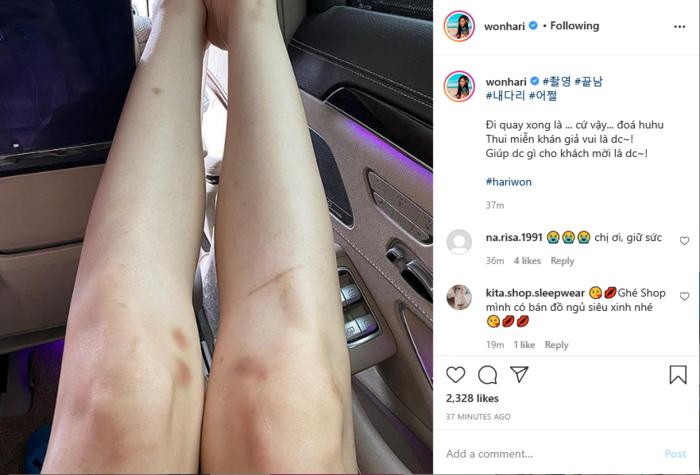 Hari Won, Ngọc Trinh bất chấp bầm dập vì nghệ thuật nhưng người cuối mới đáng ngưỡng mộ-5