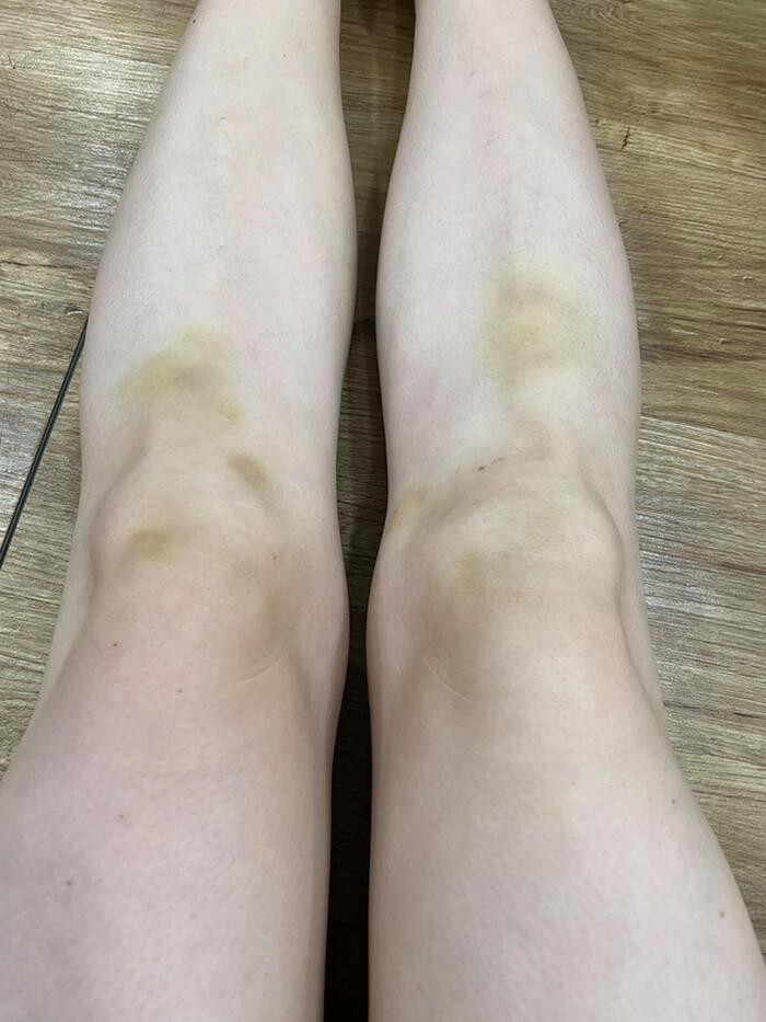 Hari Won, Ngọc Trinh bất chấp bầm dập vì nghệ thuật nhưng người cuối mới đáng ngưỡng mộ-10