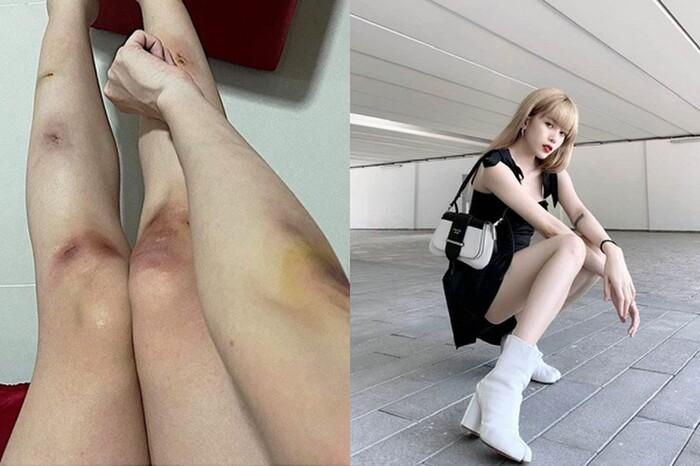 Hari Won, Ngọc Trinh bất chấp bầm dập vì nghệ thuật nhưng người cuối mới đáng ngưỡng mộ-12