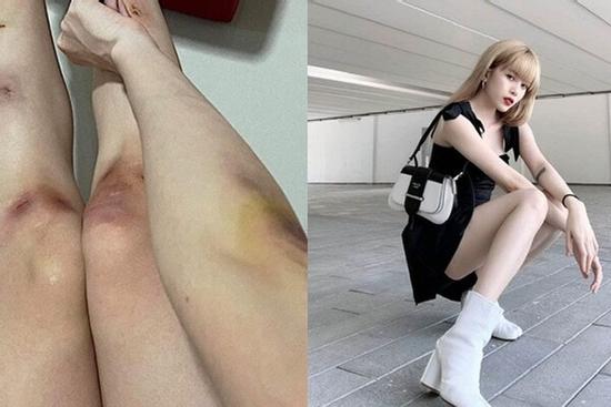 Hari Won, Ngọc Trinh bất chấp bầm dập vì nghệ thuật nhưng người cuối mới đáng ngưỡng mộ