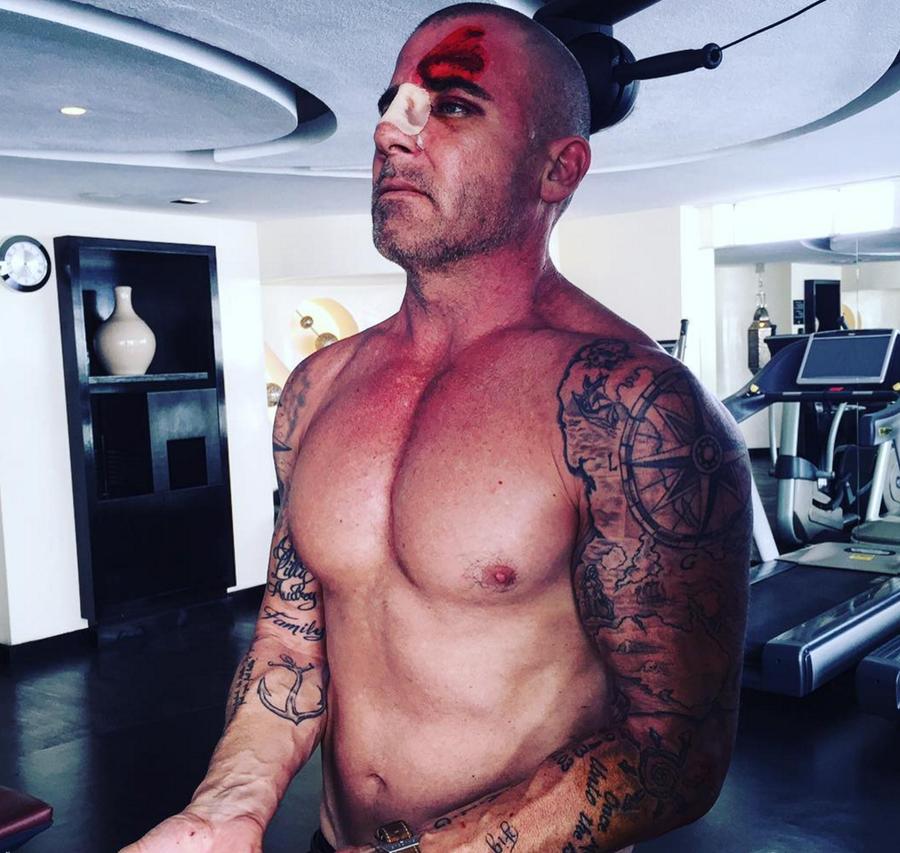 Dominic Purcell dính chấn thương nguy hiểm tính mạng: Trong khi quay mùa năm, Dominic Purcell bị tai nạn nghiêm trọng trên phim trường. Do thanh sắt rơi trúng đầu, nam diễn viên bị chấn thương đầu, gãy mũi, phải khâu 150 mũi ở bệnh viện Casablanca, Morocco. Purcell kể lại: 