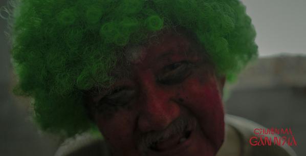 Vừa rời bệnh viện, Mạc Can ngồi xe lăn đi đóng phim ma với khuôn mặt đỏ lòm-3