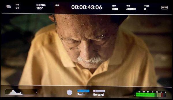 Vừa rời bệnh viện, Mạc Can ngồi xe lăn đi đóng phim ma với khuôn mặt đỏ lòm-5