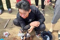 Học sinh ở Quảng Bình bị đánh bất tỉnh