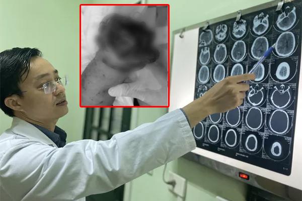 Khởi tố, bắt giam người mẹ đánh con chấn thương sọ não ở Sài Gòn-2