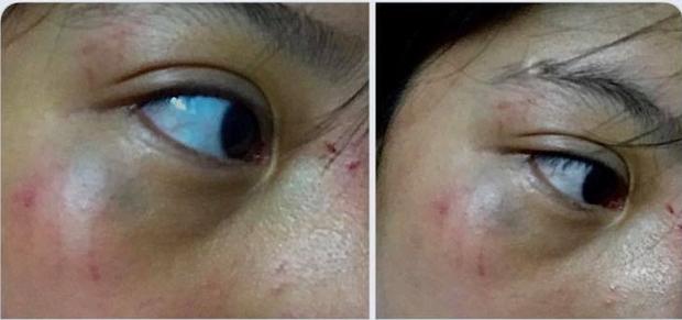 Clip: Nữ sinh lớp 8 bị nhóm bạn quây kín, đánh hội đồng dã man ở Thanh Hóa-3