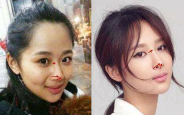 Dương Tử bị nghi ngờ thẩm mỹ, gương mặt hao hao Yoon Eun Hye-6