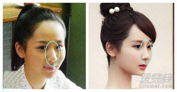 Dương Tử bị nghi ngờ thẩm mỹ, gương mặt hao hao Yoon Eun Hye-7