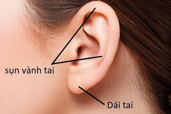 Hình ảnh sẹo đùn kín tai do nâng mũi bằng sụn tai gây sốc trên MXH và sự thật-4