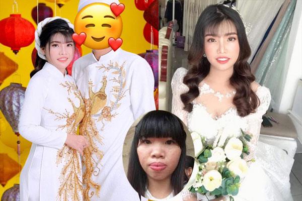 Thị Nở Quách Phượng lên xe hoa lần 2, nhan sắc sau 3 năm dao kéo gây bất ngờ-6