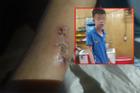 Chủ quán bánh xèo ở Bắc Ninh khai gì với công an sau khi 'tra tấn' 2 thanh niên giúp việc?