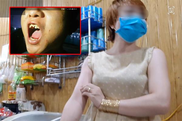 Nạn nhân 15 tuổi bị tra tấn kể nhiều lần ăn đòn bằng chày đập đá, cạo vảy cá ở lưng-4