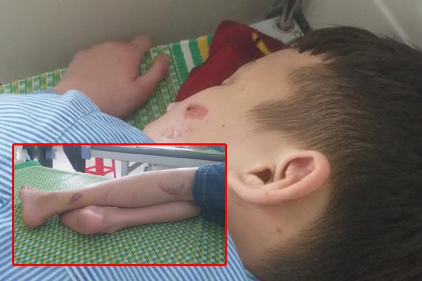 Chủ quán bánh xèo ở Bắc Ninh tra tấn nhân viên khai do họ ăn trộm tiền, ăn đồ của khách-5