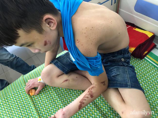 Trẻ 15 tuổi bị tra tấn ở Bắc Ninh: Anh trai nạn nhân bẻ lái khi nói về nữ chủ quán-1