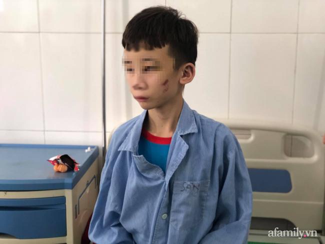 Trẻ 15 tuổi bị tra tấn ở Bắc Ninh: Anh trai nạn nhân bẻ lái khi nói về nữ chủ quán-3