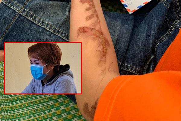 Lời khai man rợ của chủ quán tra tấn nhân viên: Lấy chổi cọ vệ sinh chọc vào mắt-5