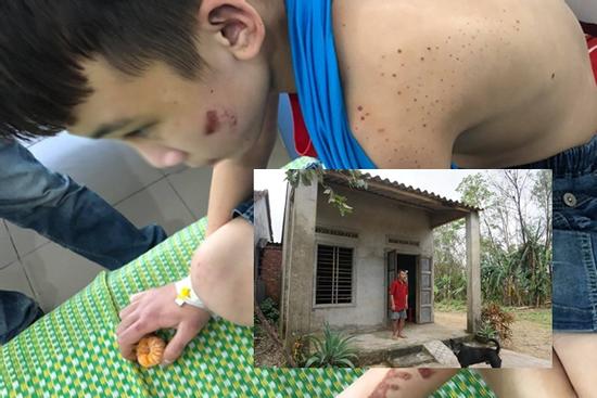 Gia cảnh thê lương của bé trai bị chủ quán bánh xèo tra tấn: Mẹ mất sớm, bố tâm thần