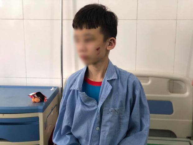 Nạn nhân thứ 2 bị bà chủ quán bánh xèo đánh đập: Bà chủ cầm dao chém, không cho đi khâu-2