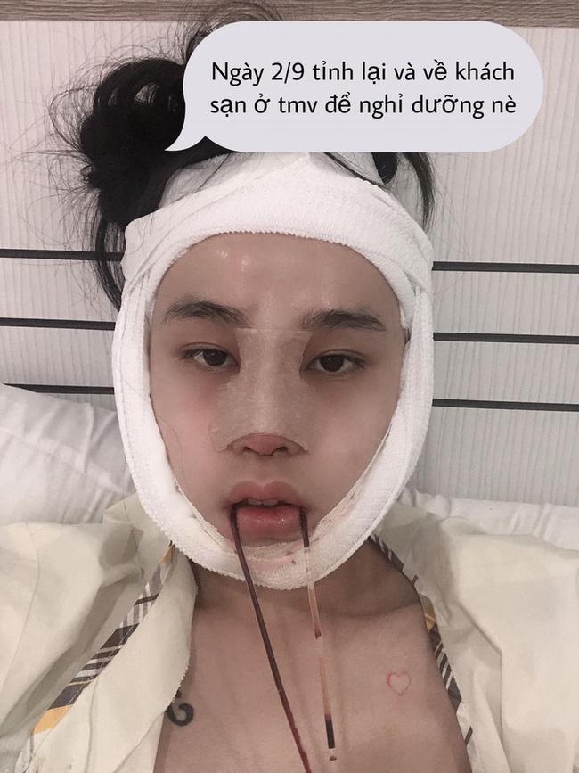 Thí sinh Hoa hậu chuyển giới kể lại hành trình dao kéo lột xác không tưởng-3