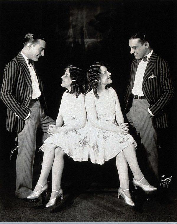 Đời sống tình dục bí ẩn của chị em dính liền, một người nằm xem người kia...-2