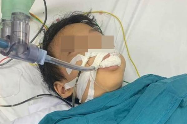 Học sinh lớp 1 ăn nhầm thuốc diệt chuột hình viên kẹo-1