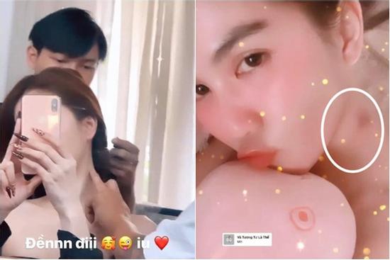 Lộ dấu hickey trên cổ, Ngọc Trinh tiết lộ luôn sự thật 'bạo hôn'