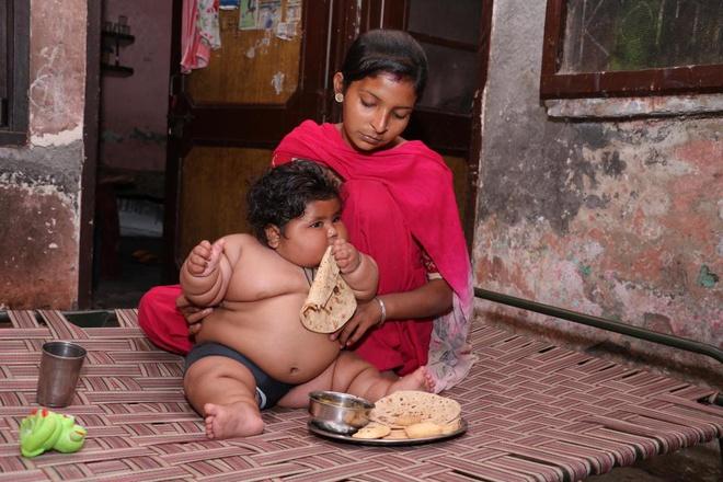 Cuộc sống bất thường của bé gái nặng nhất Ấn Độ-2