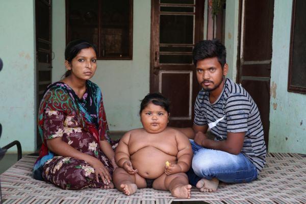 Cuộc sống bất thường của bé gái nặng nhất Ấn Độ-4