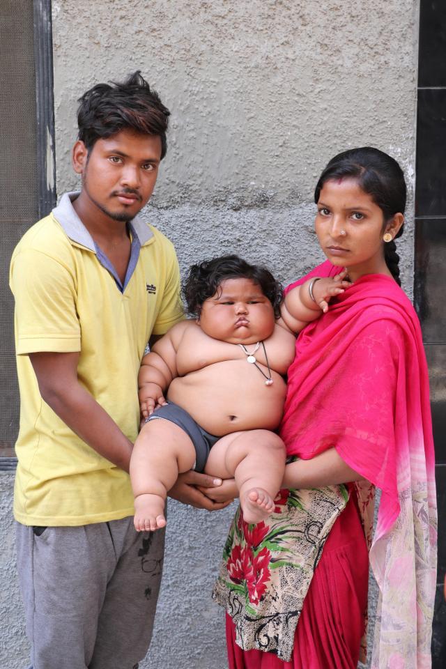 Cuộc sống bất thường của bé gái nặng nhất Ấn Độ-6