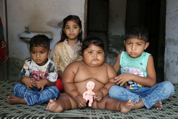 Cuộc sống bất thường của bé gái nặng nhất Ấn Độ-7