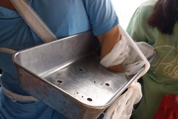 Dùng cưa máy tỉa cây, người đàn ông 62 tuổi bị cắt gần đứt lìa tay chân-5