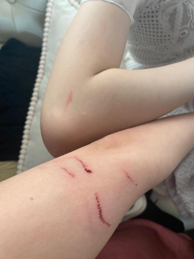 Hà Nội: Cãi vã vì mời rượu mà khách không uống, nhân viên quán bar xông vào đánh khách rách trán-1