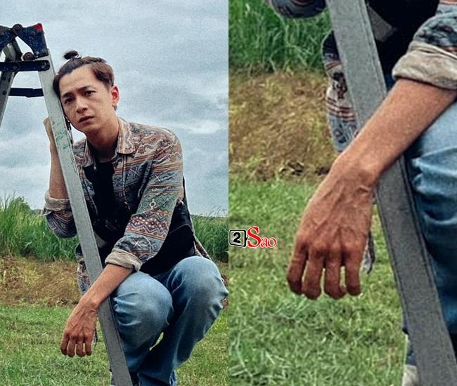 Dân mạng hốt hoảng khi nhìn bàn tay Ngô Kiến Huy-2