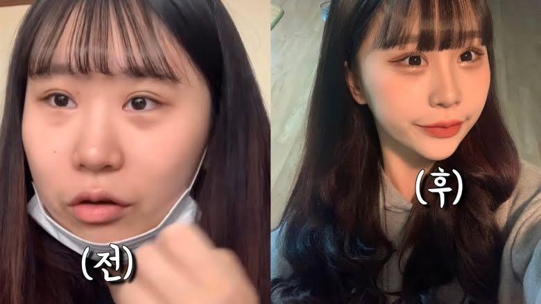 Youtuber Hàn lột xác như hot girl sau nhiều lần phẫu thuật thẩm mỹ-5