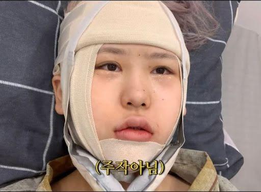 Youtuber Hàn lột xác như hot girl sau nhiều lần phẫu thuật thẩm mỹ-3