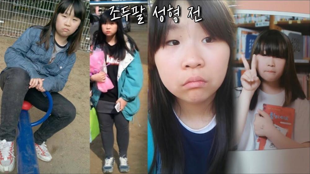 Youtuber Hàn lột xác như hot girl sau nhiều lần phẫu thuật thẩm mỹ-2