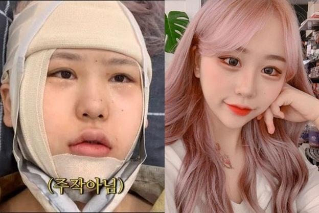 Hoa hậu nhí một thời của Mỹ vật lộn với bệnh béo phì-9