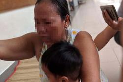 Khởi tố, bắt giam người mẹ đánh con chấn thương sọ não ở Sài Gòn