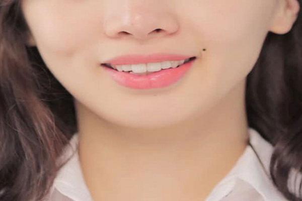 5 nốt ruồi phúc lộc báo hiệu cuộc sống lên hương, tiền bạc rủng rỉnh-4