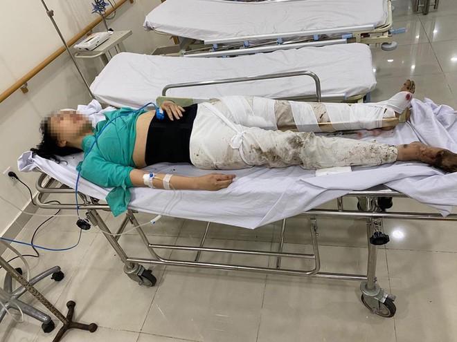 Nữ tiếp viên hàng không tham gia phiên xét xử tài xế Mercedes ngày 15/12: Tôi sẽ đi nạng tới-1