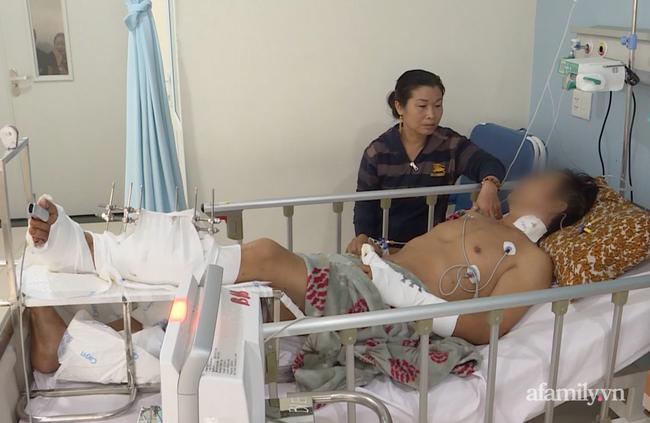 Sau câu hỏi con ông có nhà không?, côn đồ vung dao chém lìa chân người bố-1