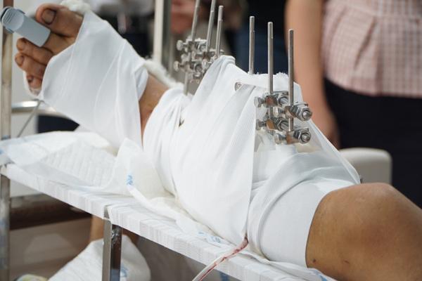 Sau câu hỏi con ông có nhà không?, côn đồ vung dao chém lìa chân người bố-3