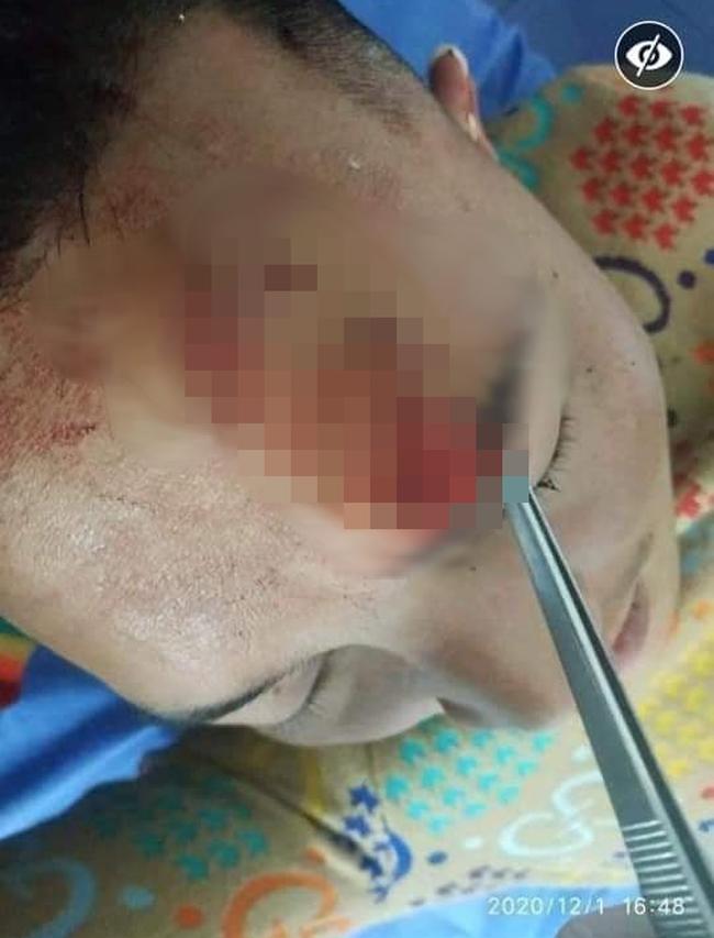 Xôn xao hình ảnh thánh đạo lý Huấn Hoa Hồng hỗn chiến, bị đánh rách đầu-2