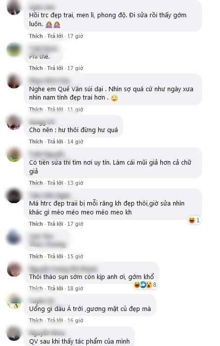 Diện mạo của Việt Anh sau dao kéo gây thất vọng: Nghe Quế Vân xúi dại, nhìn sợ quá-3